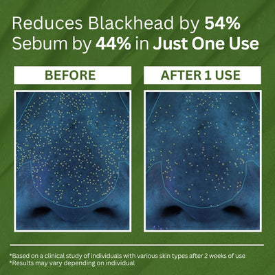 Deep Pore Bubble Cleanse