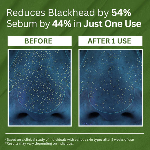 Deep Pore Bubble Cleanse